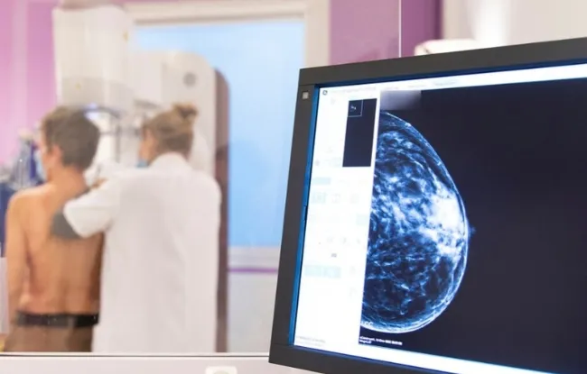Cancer du sein chez les femmes jeunes  de multiples défis à relever - Institut Curie
