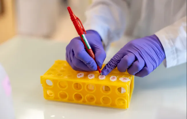 Cancers de primitif inconnu : l’Institut Curie relève le défi de soigner les métastases sans connaître la tumeur d'origine
