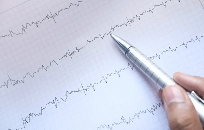 Nouvelle étude au cœur de la contraction cardiaque : mieux comprendre le rôle des myosines Institut Curie