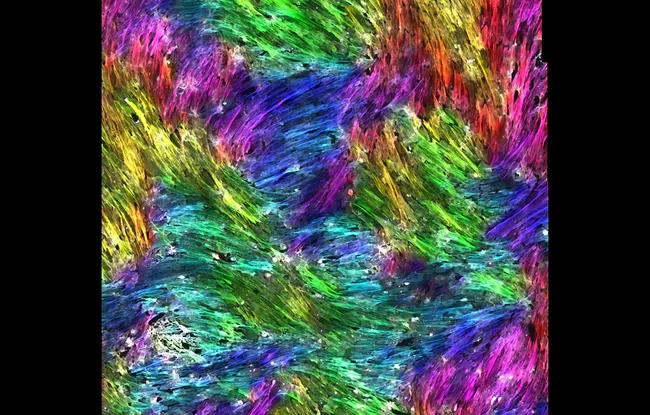 Comment certaines cellules du micro-environnement tumoral construisent un rempart qui contrôle les métastases - Institut Curie