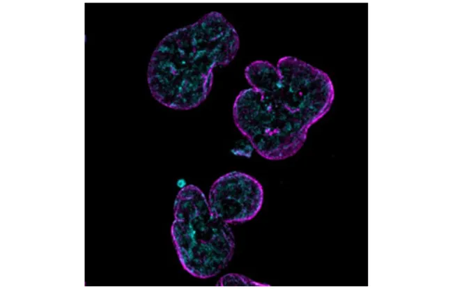 Quand le nombre de chromosomes déraille  un mécanisme inédit pour protéger l’intégrité du génome
