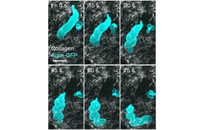 New insights on how material properties help cancer cells move and spread 