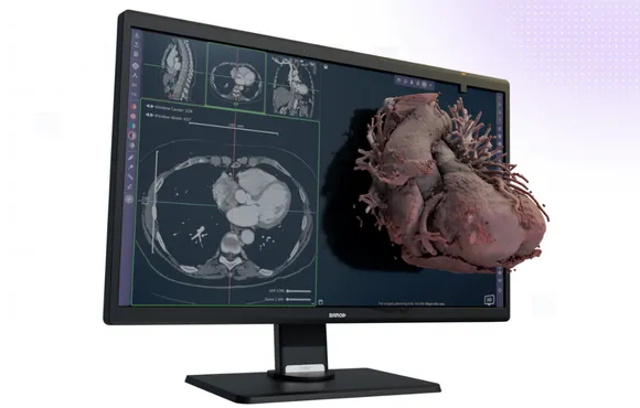 Avatar Medical, spin-off de l’Institut Curie, reçoit l'agrément de la FDA pour sa solution innovante d’imagerie médicale