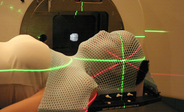  Traitement par radiothérapie conformationnelle 3D avec modulation d'intensité 