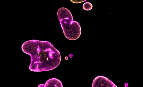 Images of distorted cells following chromosome mis-segregation