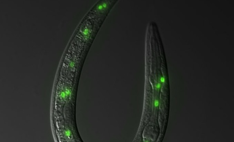 C. elegans L1 larva with seam cells labeled