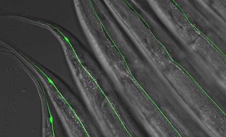 C. elegans touch receptor neurons