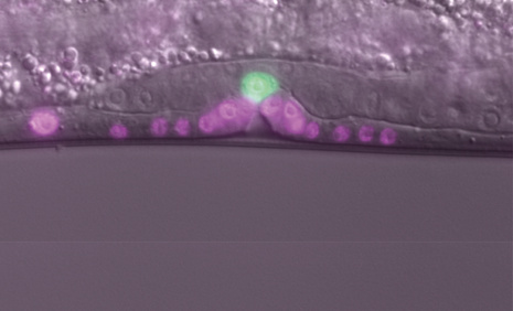 Vulval cells in magenta, Anchor cell in green