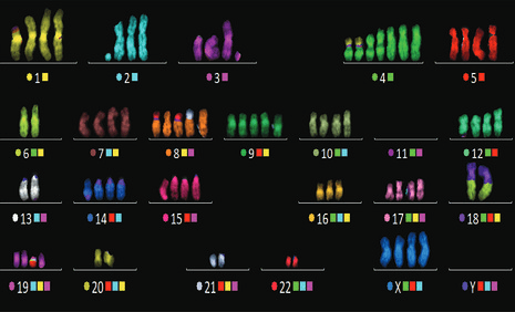 human cancer karyotype