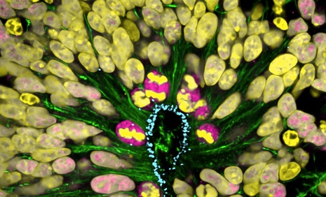 Centrosomes dans les glies radiaires d'un organoide