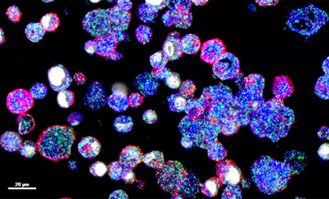 plasticité des cellules cancéreuses