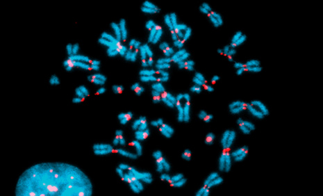 Image de chromosomes dont le centromère est coloré