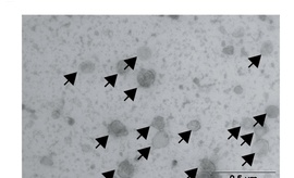 Image de microscopie électronique qui montre le cGAMP-VLP (larges sphères sur l’image, indiquées par les flèches), nouveau médicament anticancer en immunothérapie développé par l’équipe du Dr Nicolas Manel. 
