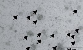 Image de microscopie électronique qui montre le cGAMP-VLP (larges sphères sur l’image, indiquées par les flèches), nouveau médicament anticancer en immunothérapie développé par l’équipe du Dr Nicolas.